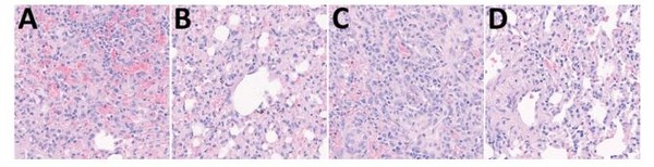 A: 델타변이주가 직접 감염된 개의 폐조직 B: 델타변이주가 전파된 개의 폐조직 C: 오미크론이 직접 감염된 개의 폐조직 D: 오미크론이 전파된 개의 폐 조직 [논문 발췌]