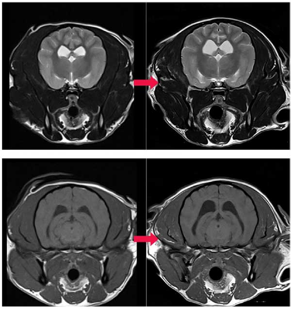 △AI 도입 후 품질이 개선된 MRI 영상 사진